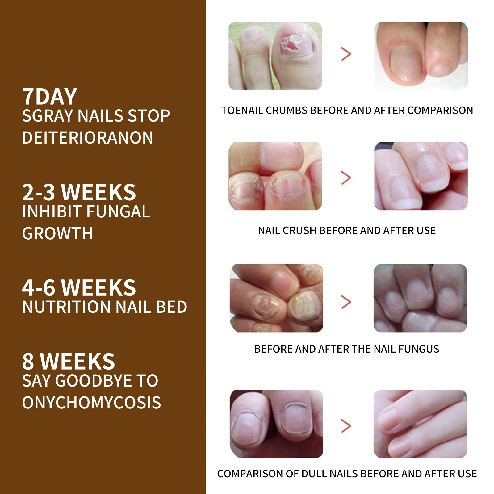 3PCS Nail Growth Deep Healing Organic Serum, Nail Growth Nail Serum, Reconstrux Nail Growth, Nail Growth and Strengthening Serum, Nail Serum for Growth and Repair for Damaged Nails - Exclusive Design
