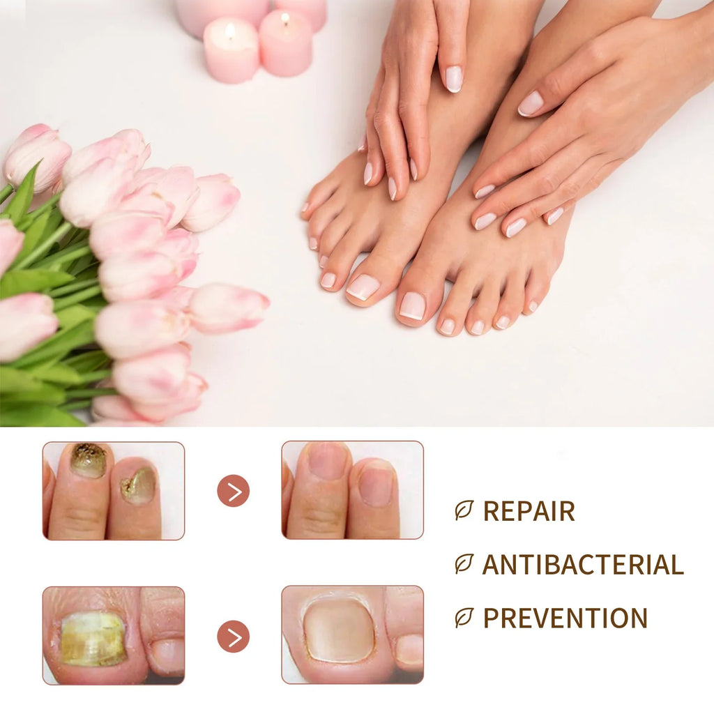 3PCS Nail Growth Deep Healing Organic Serum, Nail Growth Nail Serum, Reconstrux Nail Growth, Nail Growth and Strengthening Serum, Nail Serum for Growth and Repair for Damaged Nails - Exclusive Design