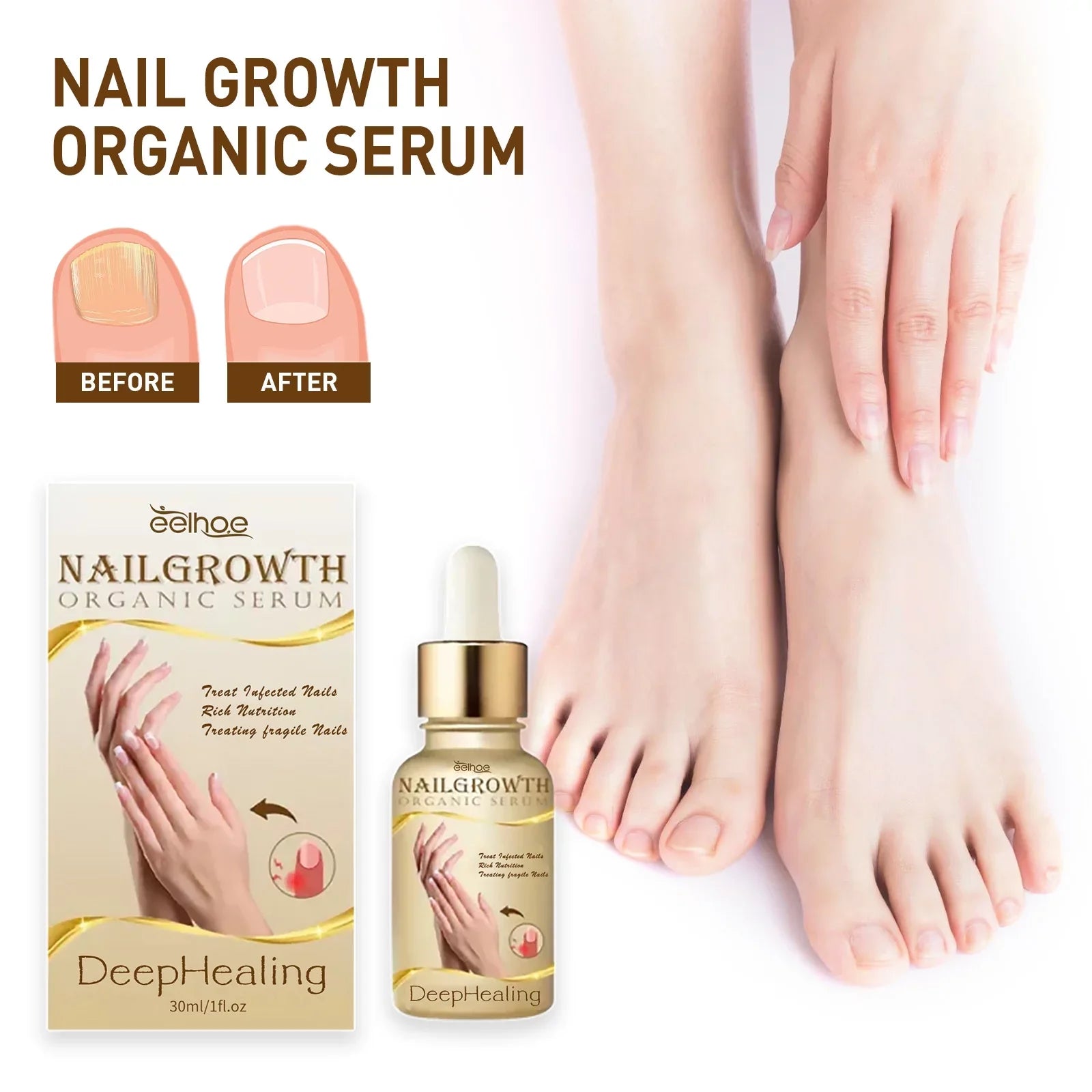 3PCS Nail Growth Deep Healing Organic Serum, Nail Growth Nail Serum, Reconstrux Nail Growth, Nail Growth and Strengthening Serum, Nail Serum for Growth and Repair for Damaged Nails - Exclusive Design