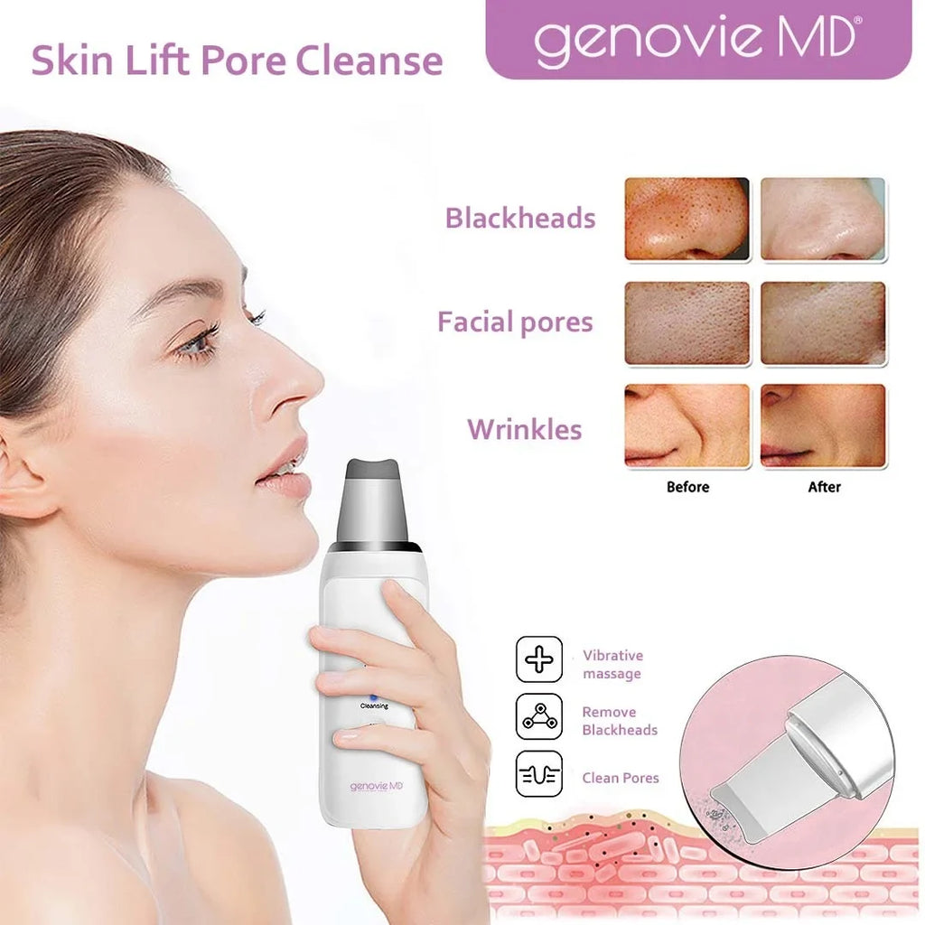 Genovie MD Skin Scrubber And Pore Cleanse, Face Spatula, Blackhead Remover, Acne Removal Tool, Deep Facial Cleaning