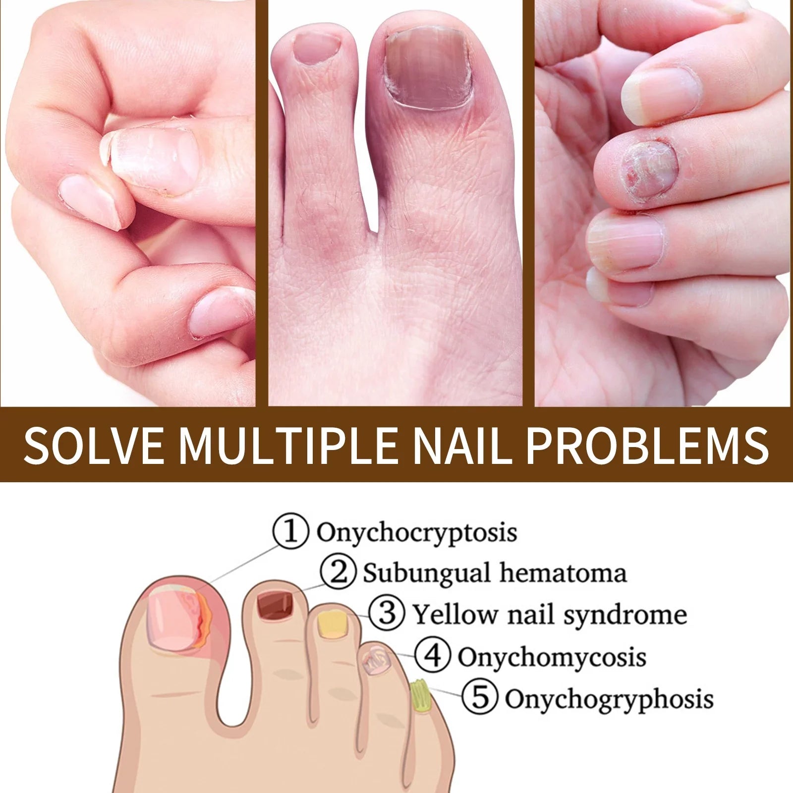 3PCS Nail Growth Deep Healing Organic Serum, Nail Growth Nail Serum, Reconstrux Nail Growth, Nail Growth and Strengthening Serum, Nail Serum for Growth and Repair for Damaged Nails - Exclusive Design